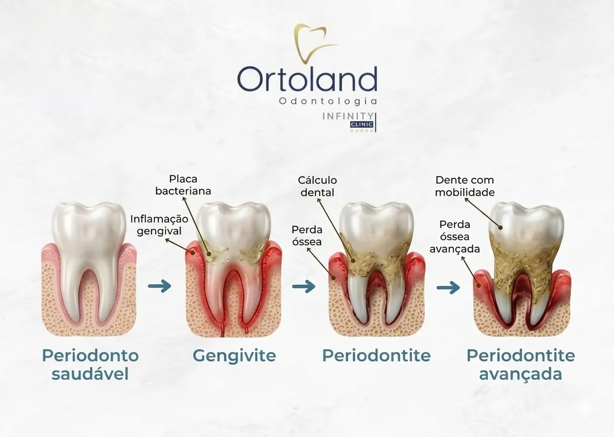 Problemas periodontais